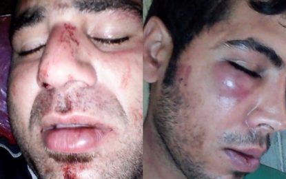 Iranian refugees on Manus allegedly assaulted by PNG police