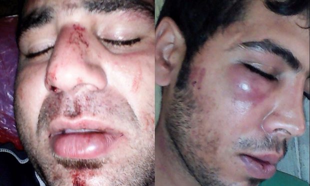 Iranian refugees on Manus allegedly assaulted by PNG police